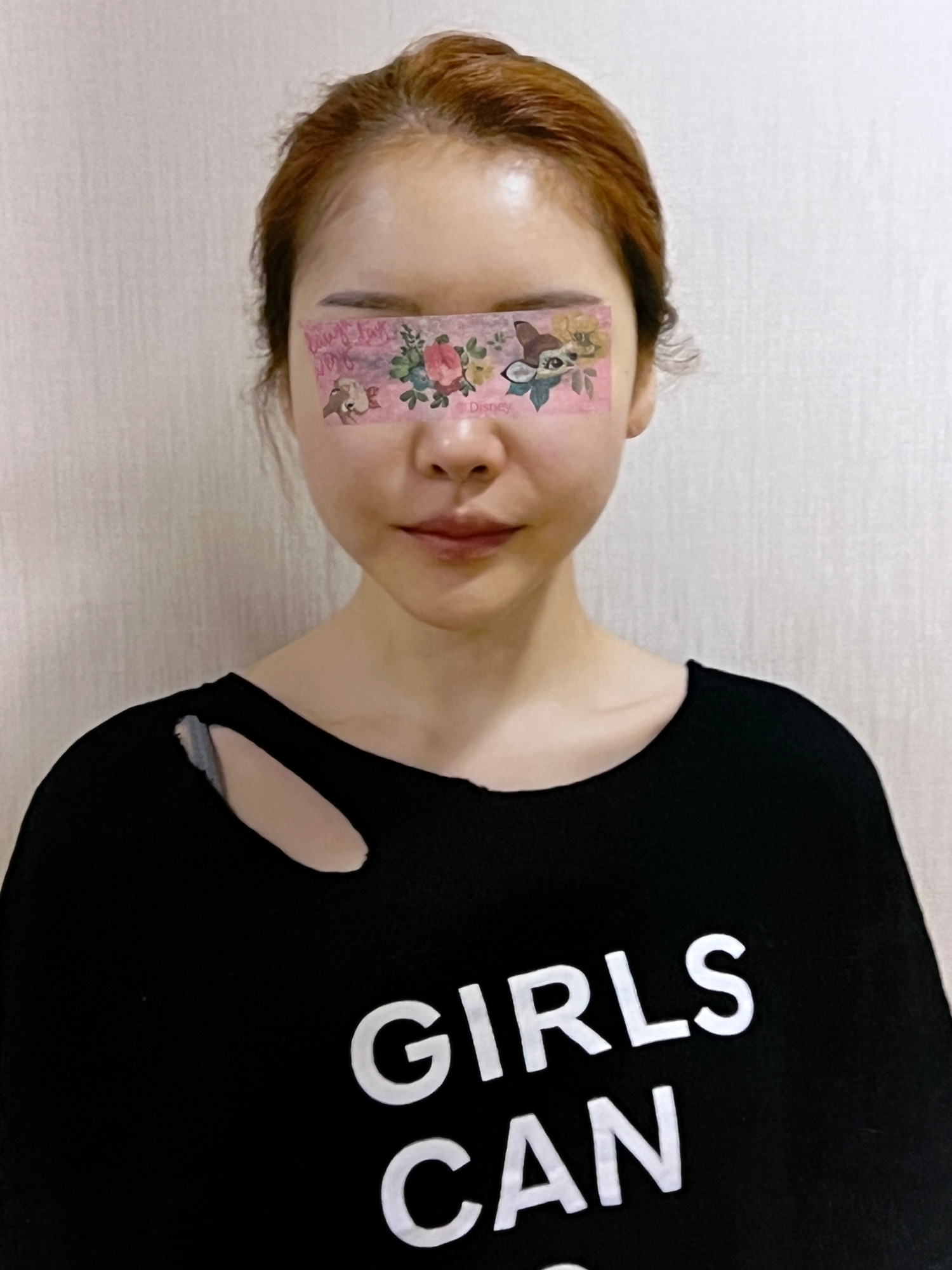 CASE 01 시술 후